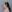 Short nose correction (nose lengthening / derotation) — Saegim Plastic Surgery Clinic