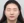 ฉีดสเต็มเซลล์ (Stem cell injection) — หลังทำ (30วัน) · คลินิก AB Aesthetic Surgery