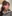 鼻尖形成術（自家軟骨移植） — ゼロワン美容外科クリニック