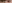 二重まぶた（自然癒着法） — フルルン美容外科クリニック