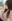 鼻尖形成術（寄贈軟骨使用） — ウィバース美容外科クリニック