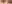 裏ハムラ法（経結膜的眼窩脂肪移動術） — ファクト美容外科クリニック