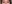 Lower Eyelid Fat Repositioning (transconjunctival) — Pleasure Plastic Surgery Clinic
