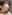 団子鼻修正（鼻尖縮小術） — ヒューマン美容外科