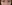 裏ハムラ法（経結膜的眼窩脂肪移動術） — リンク美容外科クリニック