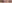 裏ハムラ法（経結膜的眼窩脂肪移動術） — ファクト美容外科クリニック