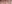 裏ハムラ法（経結膜的眼窩脂肪移動術） — ルホ美容外科クリニック