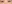 裏ハムラ法（経結膜的眼窩脂肪移動術） — アンド美容外科クリニック