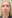 Full-face fat grafting (autologous fat transfer) — Anersty Plastic Surgery Clinic