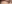 涙袋形成（脂肪注入） — ファクト美容外科クリニック