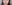 唇のヒアルロン酸注入（リップヒアルロン酸） — ロリポップ美容外科クリニック