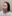 Soprano Titanium laser lifting (Alma trio-wavelength diode laser skin tightening) — Beauty & Young Clinic