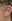 Facelift (rhytidectomy) — Uri Plastic Surgery Clinic