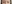裏ハムラ法（経結膜的眼窩脂肪移動術） — ウィバース美容外科クリニック
