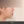 ศัลยกรรมยกริมฝีปากบน (Lip Lift) — ก่อนทำ (7วัน) · คลินิกเสริมความงามคลีฟ