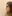 Platysma plication (corset platysmaplasty for double chin/jawline) — Dasipium Plastic Surgery Clinic