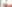 団子鼻修正（鼻尖縮小術） — ビギン美容外科クリニック