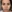 revision rhinoplasty — Coco Line Clinic