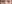 二重まぶた（自然癒着法） — プロミス美容外科クリニック