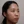 Thread embedding acupuncture lift (Korean-medicine 'maeseon' acupoint thread lift) — before · Garoseo Oriental Clinic - Gangnam Branch
