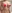 乳房挙上術（バストリフト）＋豊胸術 — バナナ美容外科クリニック