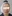 Facelift (rhytidectomy) — DM Plastic Surgery Clinic