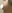 豊胸術（シリコンインプラント／人工乳腺） — ソウルアイ美容外科クリニック