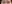 二重まぶた（自然癒着法） — プロミス美容外科クリニック