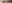 ミニリフト（小切開フェイスリフト） — ザフィックス美容外科クリニック