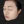 Onda (Coolwaves ไมโครเวฟ ลดไขมันและยกกระชับ) — หลังทำ · คลินิกรีไฟน์