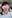 Lip lift (philtrum reduction) — Ondo Plastic Surgery