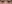 裏ハムラ法（経結膜的眼窩脂肪移動術） — ファクト美容外科クリニック