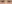 裏ハムラ法（経結膜的眼窩脂肪移動術） — ムイ美容外科クリニック
