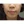 ฉีดไขมันตัวเองทั้งใบหน้า (ศัลยกรรมเติมไขมันใบหน้า) — ก่อนทำ (14วัน) · ซุนพลัสศัลยกรรมพลาสติก
