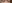 眼瞼下垂手術（目つき矯正） — ルホ美容外科クリニック