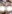 額リフト（前額リフト） — ザフィックス美容外科クリニック