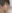 二重あごの脂肪吸引（顎下脂肪吸引） — ルホ美容外科クリニック