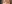 目頭切開（蒙古襞除去） — アイフィット美容外科クリニック