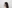 Hairline hair transplant (hairline lowering by grafting) — MoPro Clinic