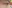 淚溝脂肪移位（內開眼袋脂肪重置） — Saekim 整形外科診所