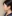 鼻尖形成術（自家軟骨移植） — サムサオ美容外科クリニック
