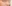 鼻尖形成術（自家軟骨移植） — ベリーグッド美容外科