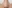 Nasal tip surgery (tipplasty) — Coco Line Clinic