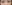 裏ハムラ法（経結膜的眼窩脂肪移動術） — プレジャー美容外科クリニック