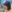 小鼻縮小術 — オブジェ美容外科クリニック