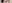 二重まぶた（自然癒着法） — プロミス美容外科クリニック