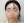 PRP自體脂肪移植（自體脂肪填補＋高濃度血小板血漿） — 術前 (30天) · 清潭OK醫美診所