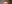 額縮小術（生え際下げ・ヘアライン下降術） — 風が吹く日にも美容外科クリニック