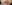 口角のヒアルロン酸注入 — ドレス美容外科クリニック