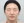 ฉีดสเต็มเซลล์ (Stem cell injection) — ก่อนทำ (30วัน) · คลินิก AB Aesthetic Surgery